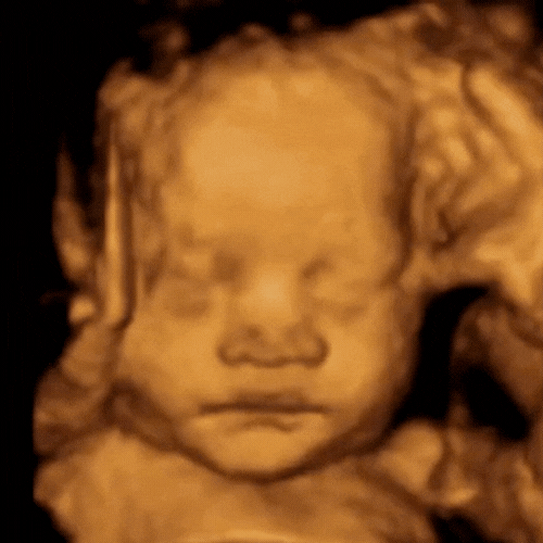 ScanSanctuary2025-ClientScans-5.gif