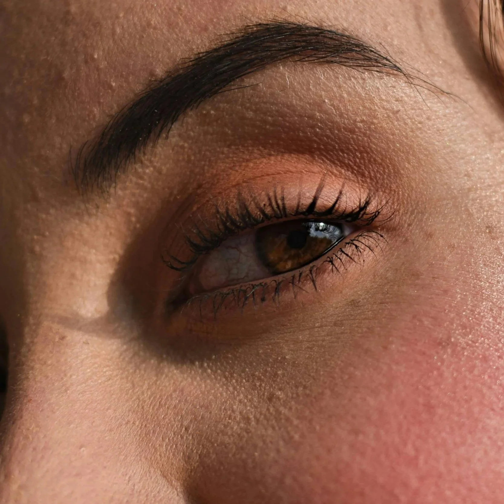 BROW LIFT