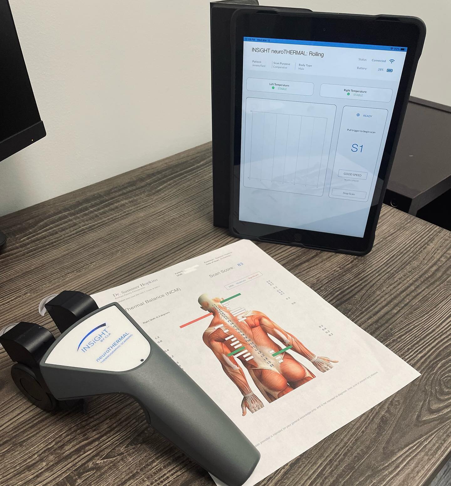When was the last time you had your nervous system checked? 🤔
In our office, we use this state-of-the-art technology known as the CLA Insight Scanner to better understand how well your nervous system is functioning! This scans gives us immediate res