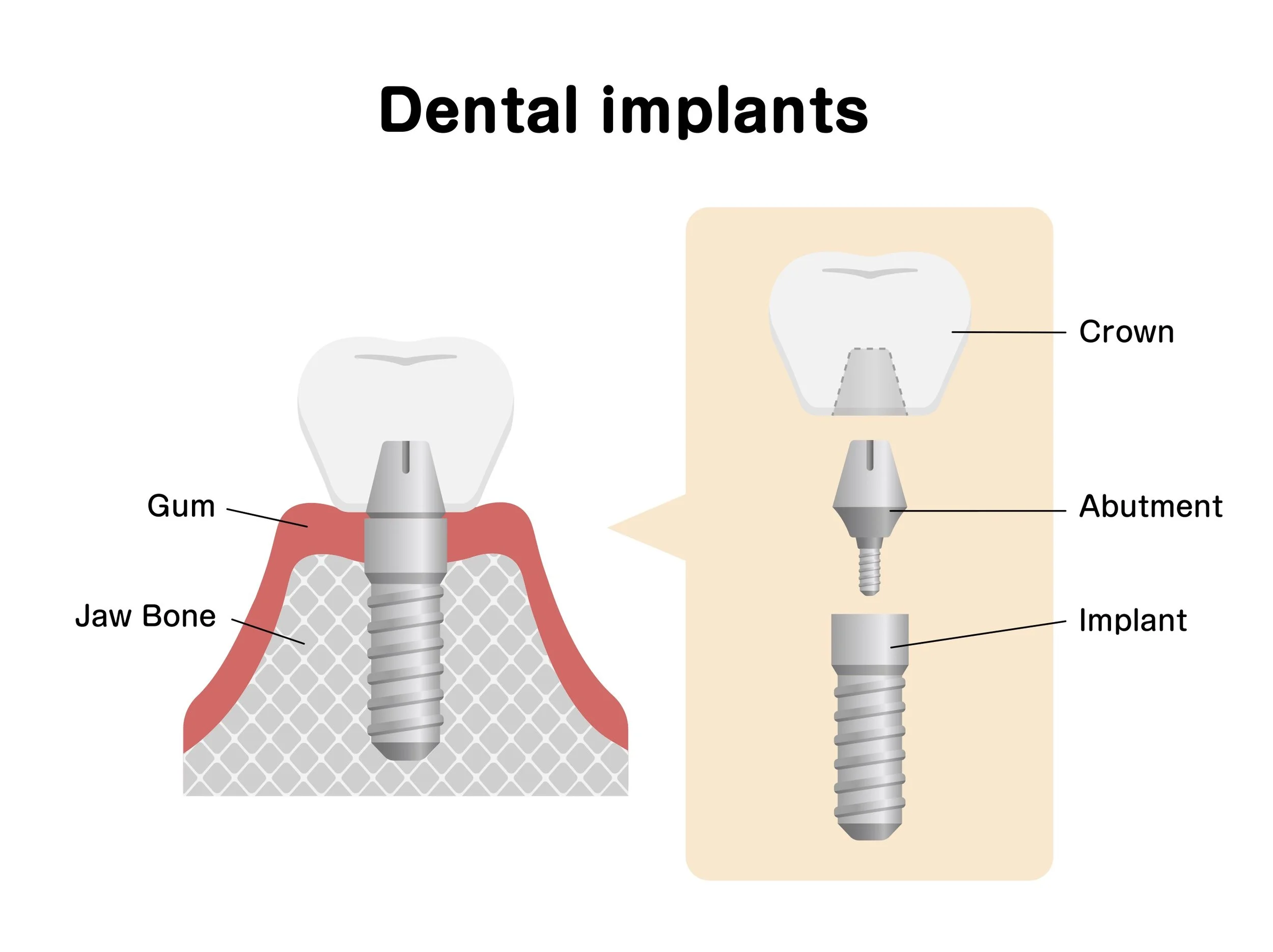 Dentist Portland, Maine — Inspire Dental of Maine