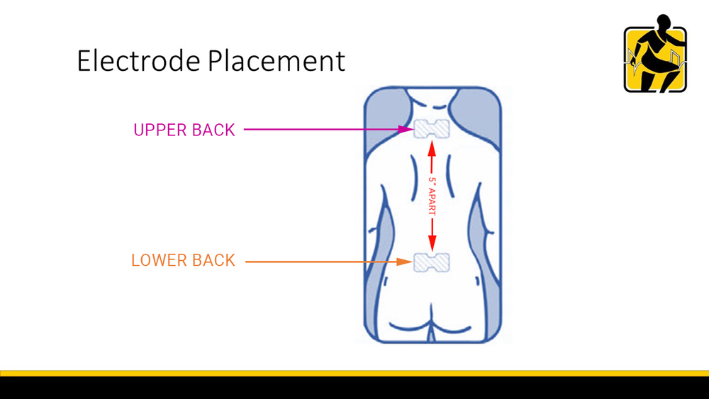 10 Facts About TENS (Transcutaneous Electrical Nerve Stimulation) - Premier  Neurology & Wellness Center