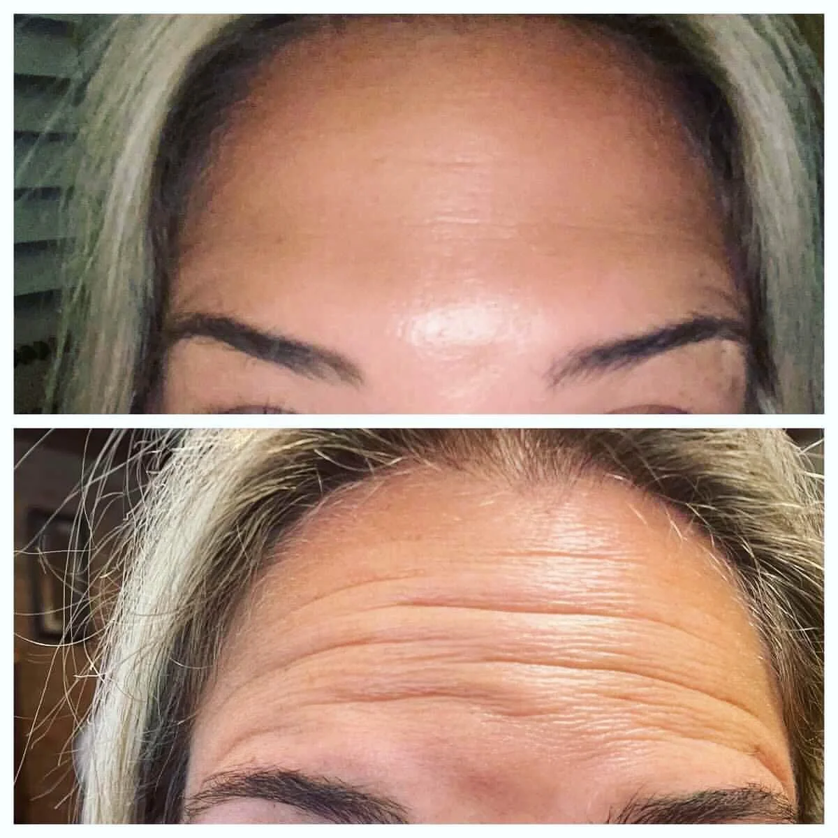 No Appointment Needed: Saturday Morning Botox, B12, IV Hydration and More