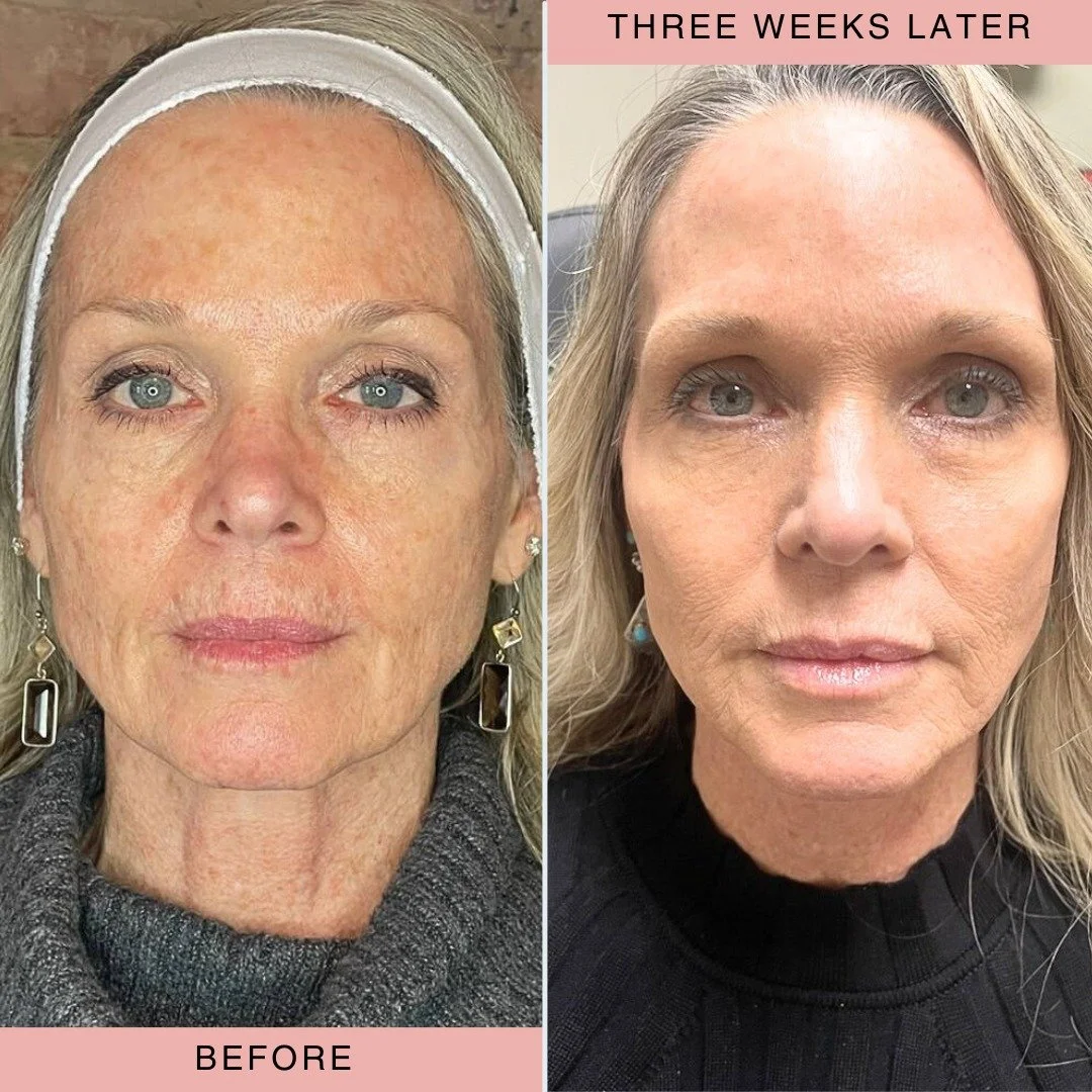Three Weeks Later