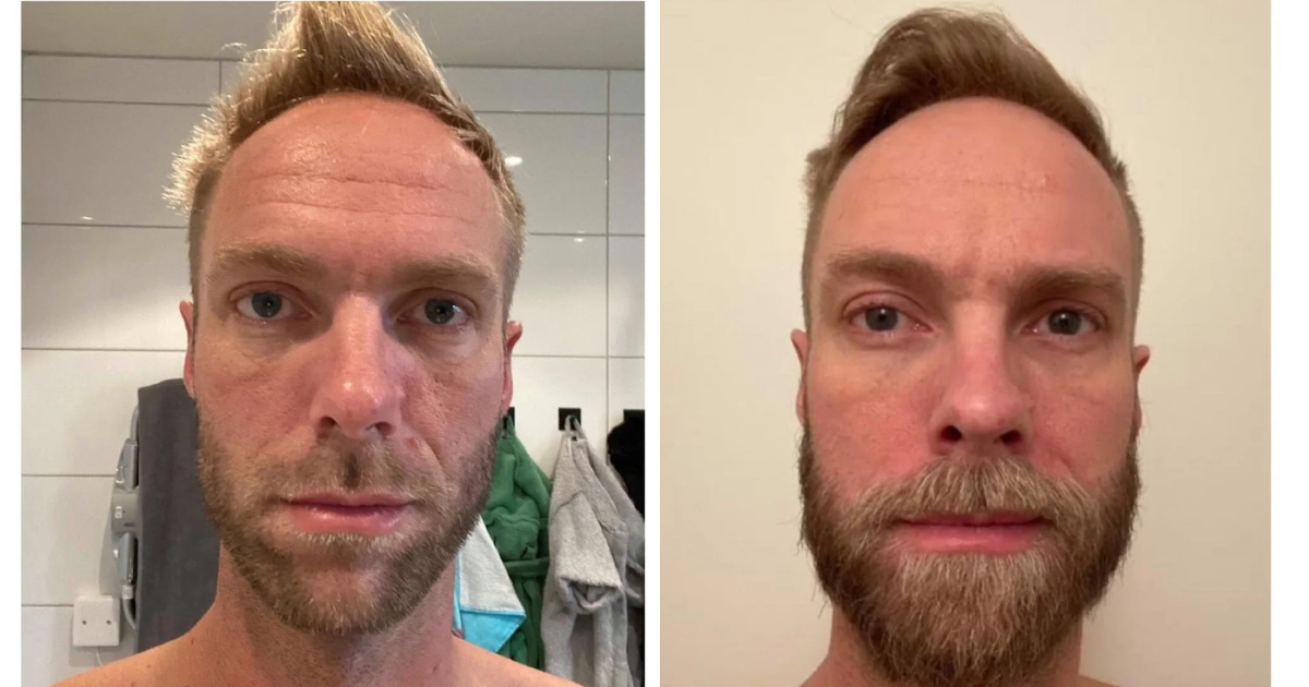 Male Client Result: Before and After Pictures &amp; Story