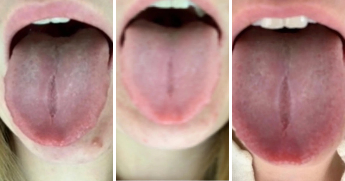 If you lack motivation? What happens then?