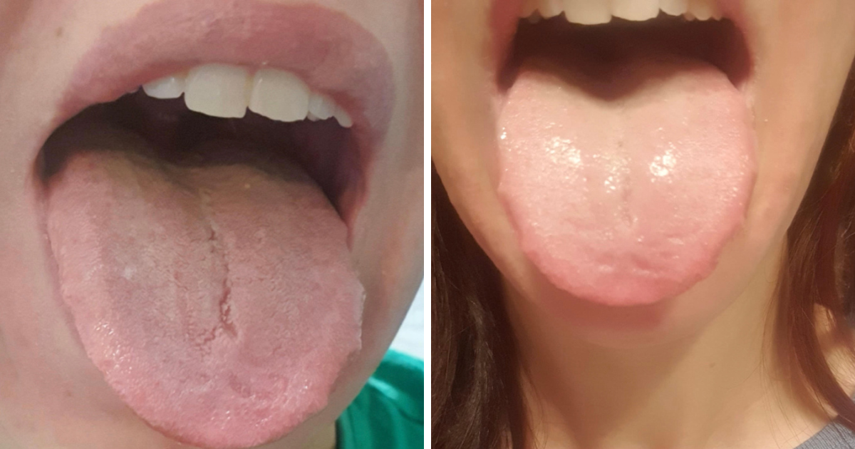 IBS, sömnproblem och stress i bagaget 