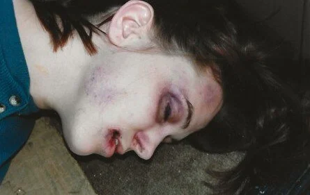 effects : wounds 1 copy.jpeg