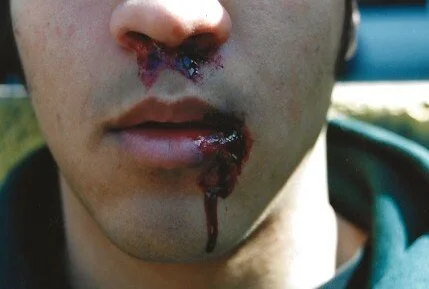 effects : wounds 2.jpeg