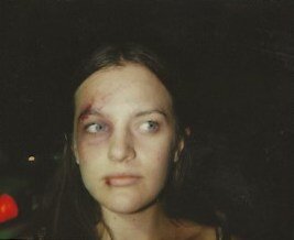 effects : wounds 3.jpeg