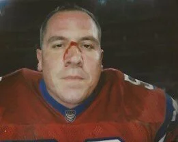 effects : wounds 4.jpeg