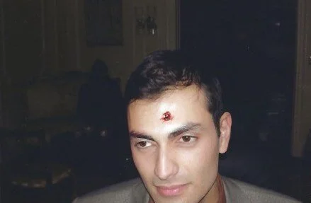 effects : wounds 5.jpeg