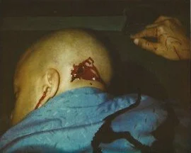 effects : wounds 6.jpeg