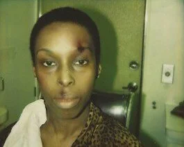 effects : wounds 9 copy 2.jpeg