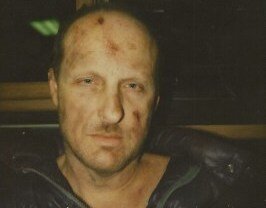 effects : wounds 9.jpeg