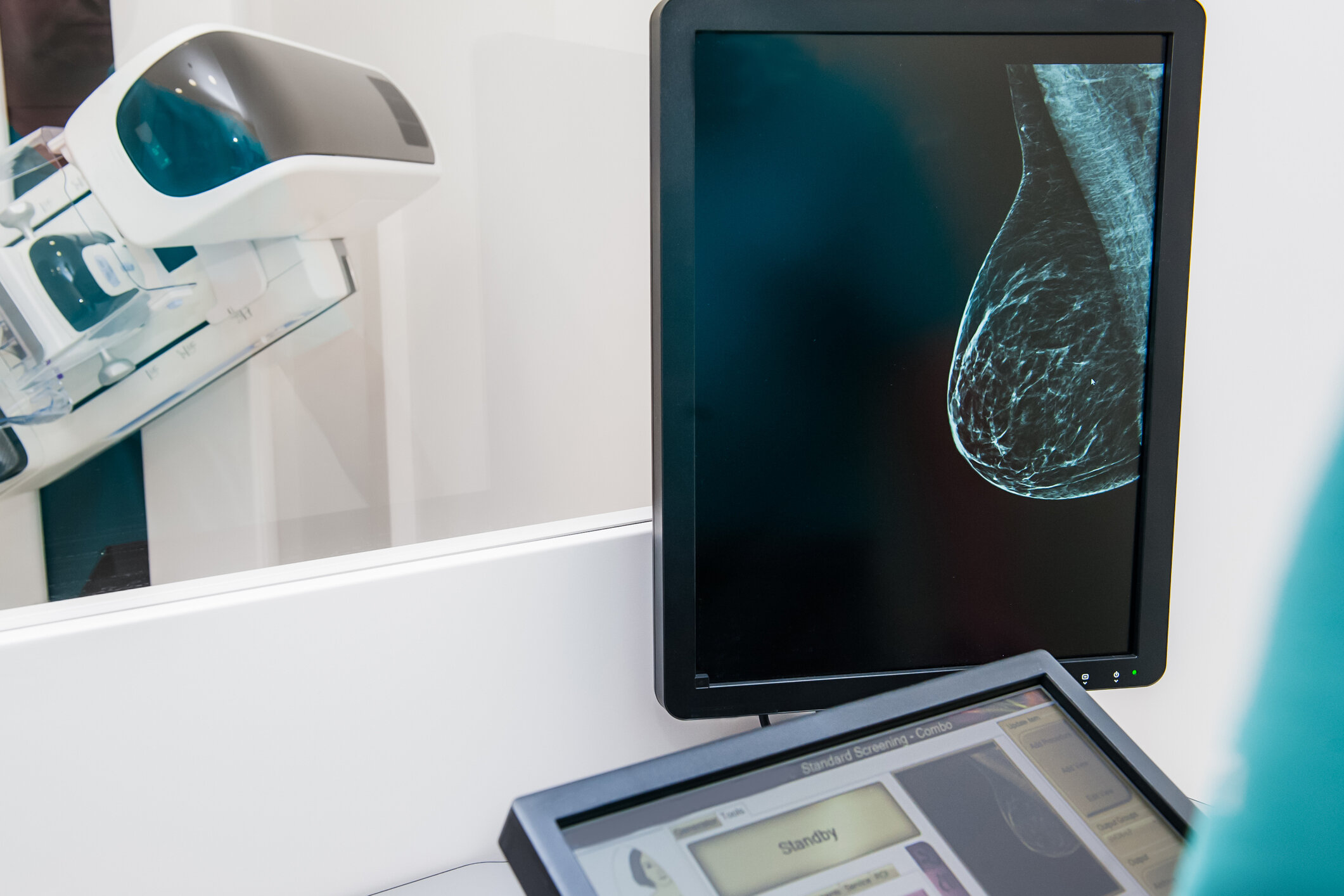 Breast Tomosynthesis