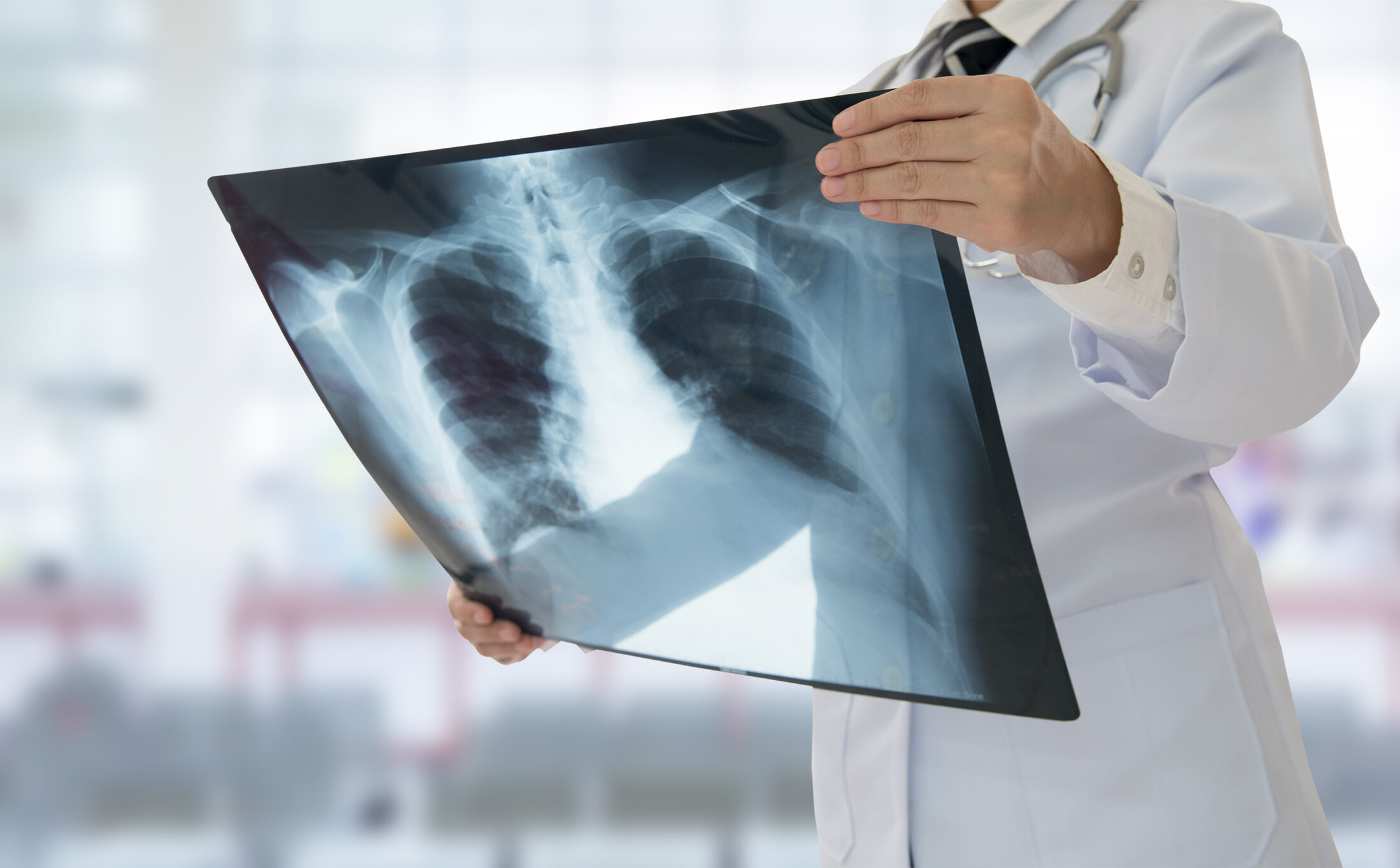 Radiograph (X-ray)
