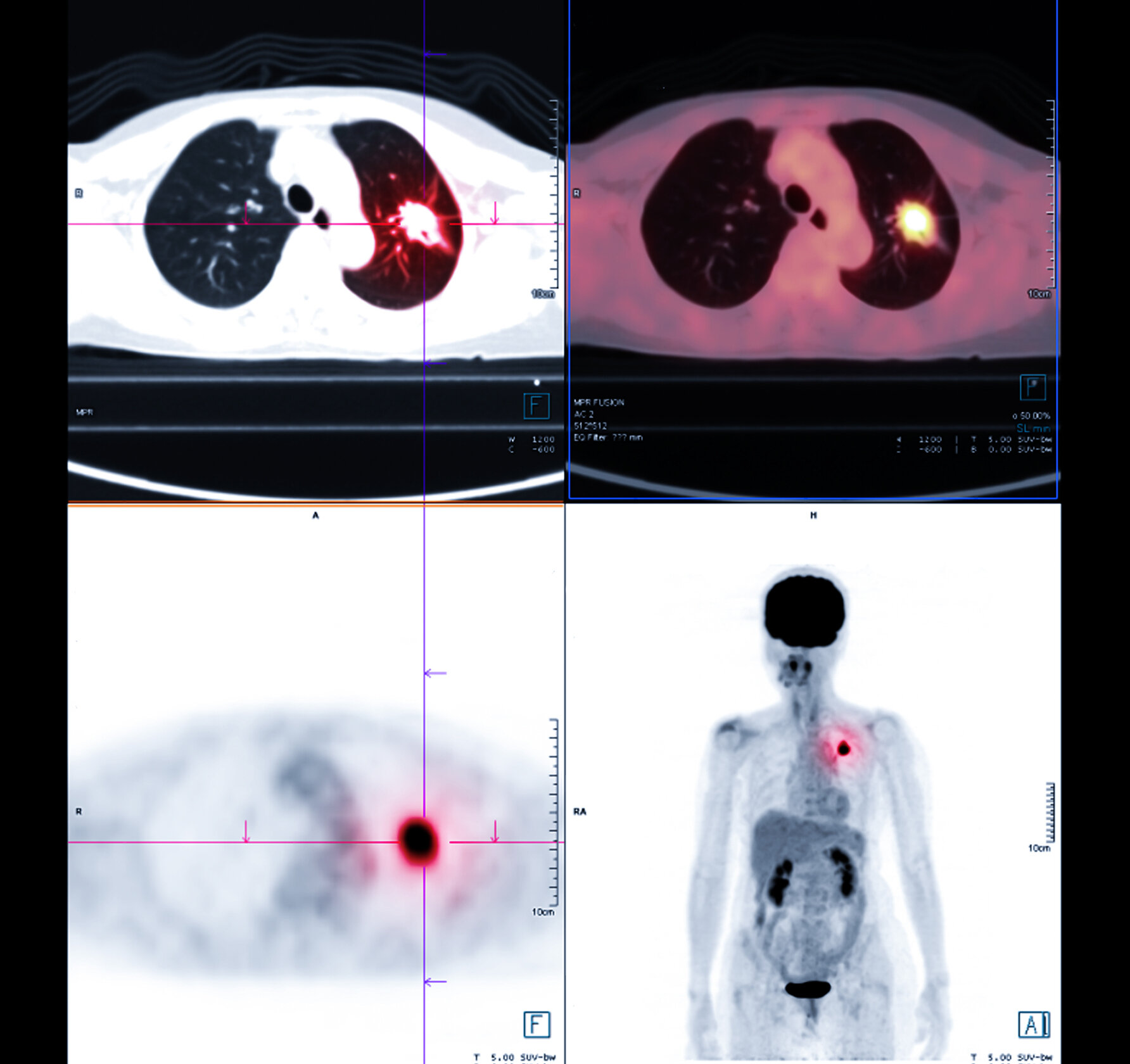 Nuclear Medicine