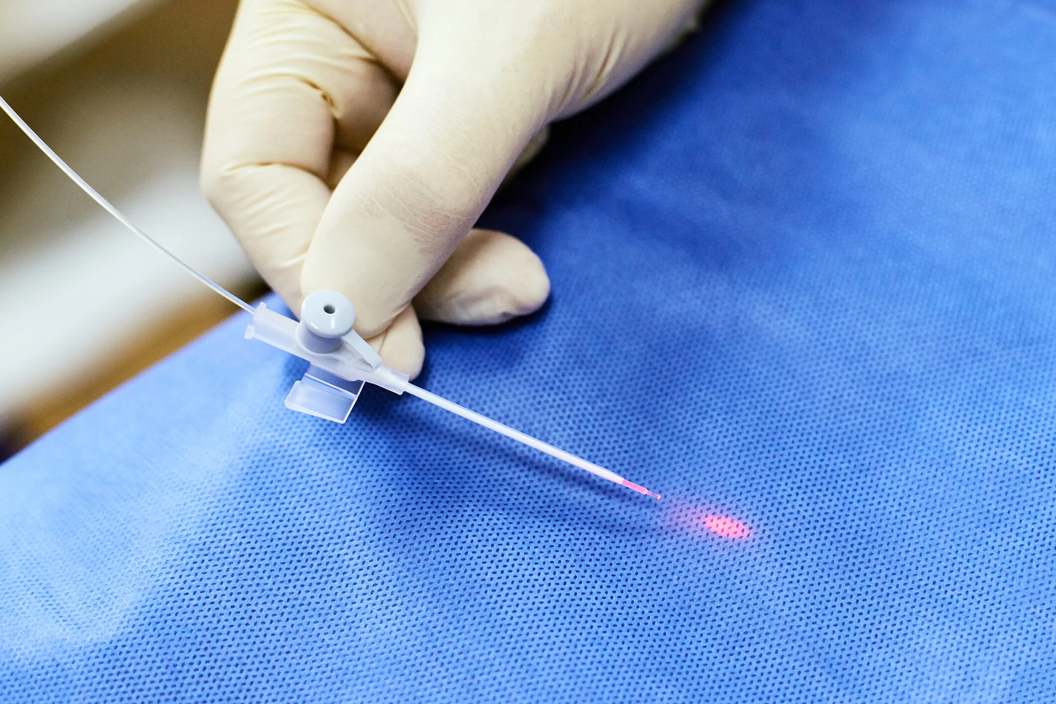 Endovascular Laser Ablation (EVLT)