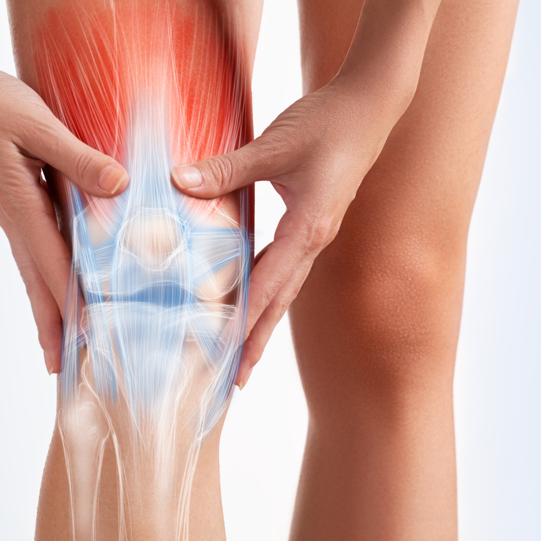 Knee Osteoarthritis: Causes, Symptoms, and Evidence-Based Treatments
