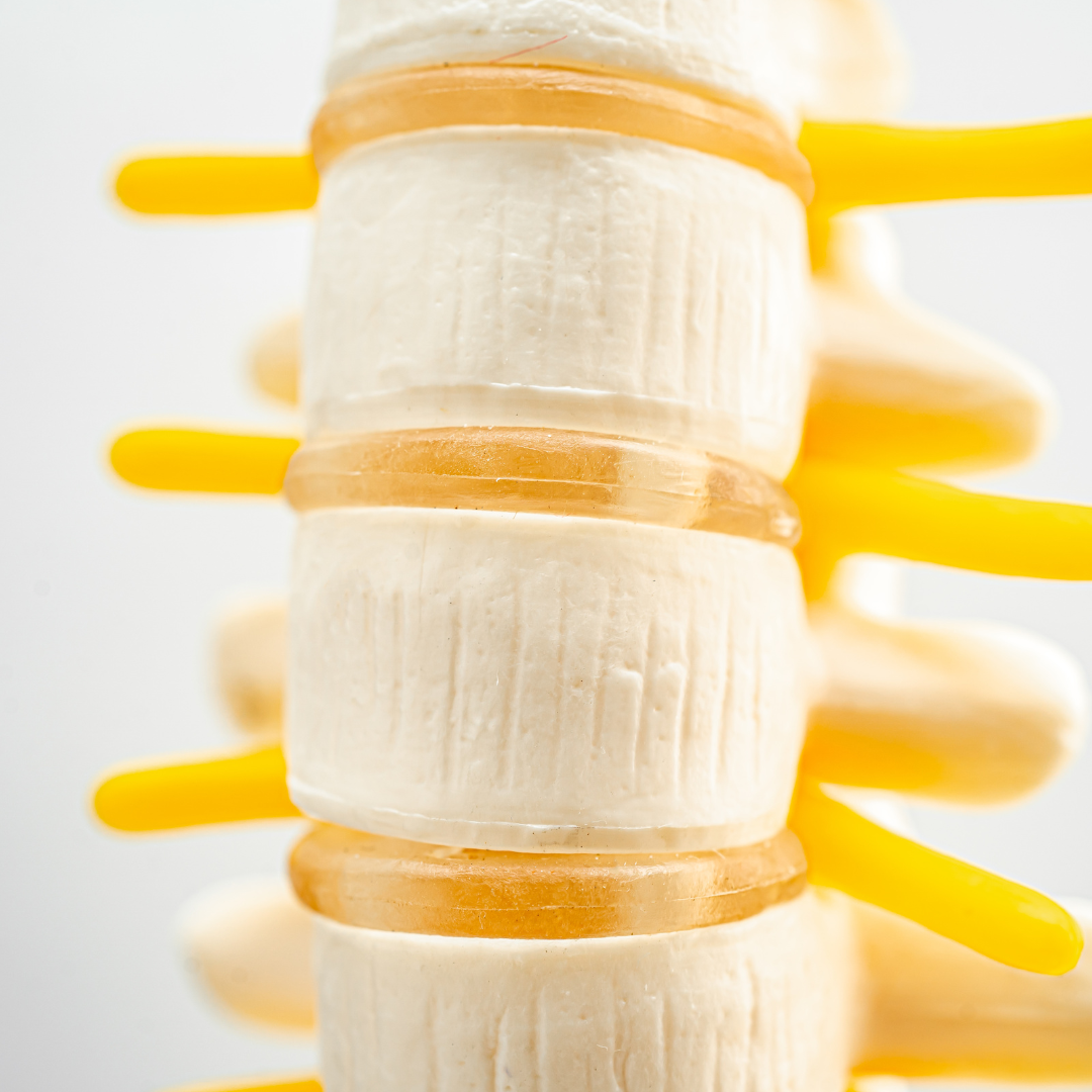 Learn More About Lumbar Disc Herniations and How Physical Therapy Can Help