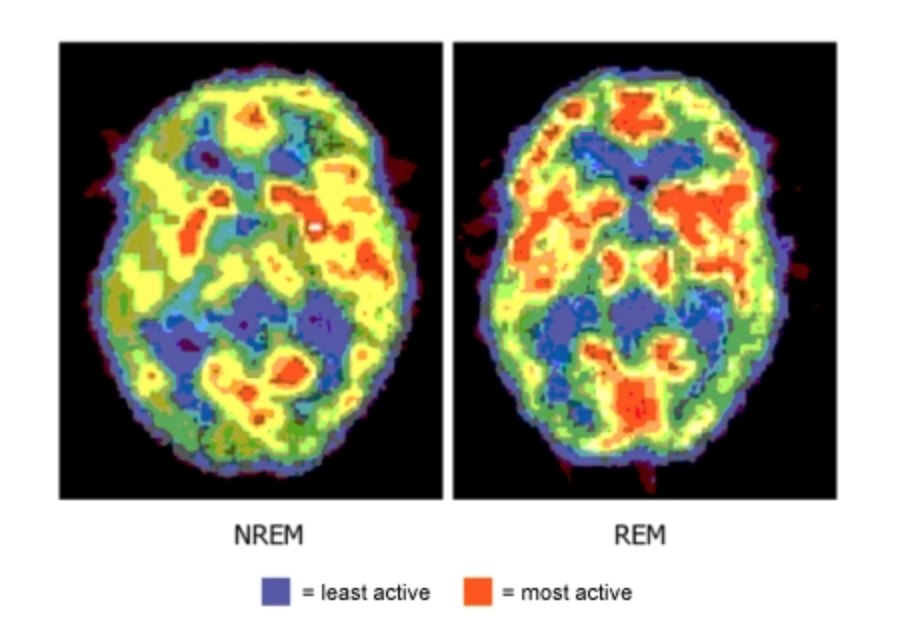 CuriouSTEM - The Brain Activity when you Sleep