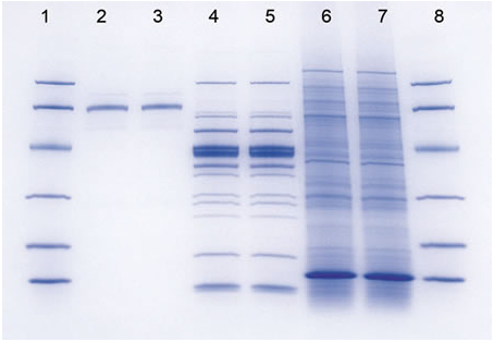 Biochemistry Techniques: Protein Staining