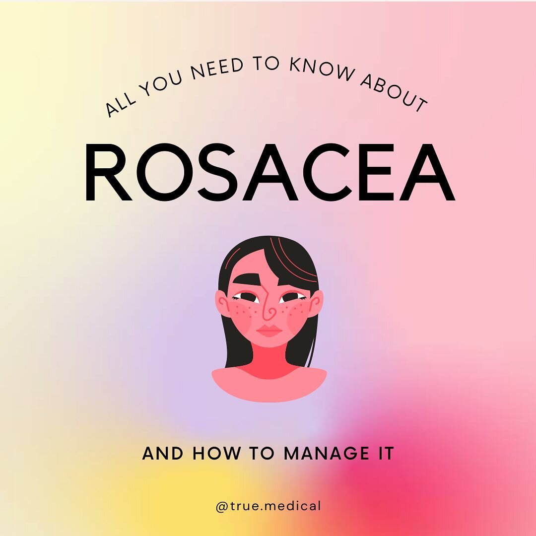 Rosacea is the blush-like redness that usually appears on the face, which can be triggered by factors such as stress, exercise and food! As it progresses, Rosacea can result in itching or burning sensations if not managed or left untreated.

Swipe le
