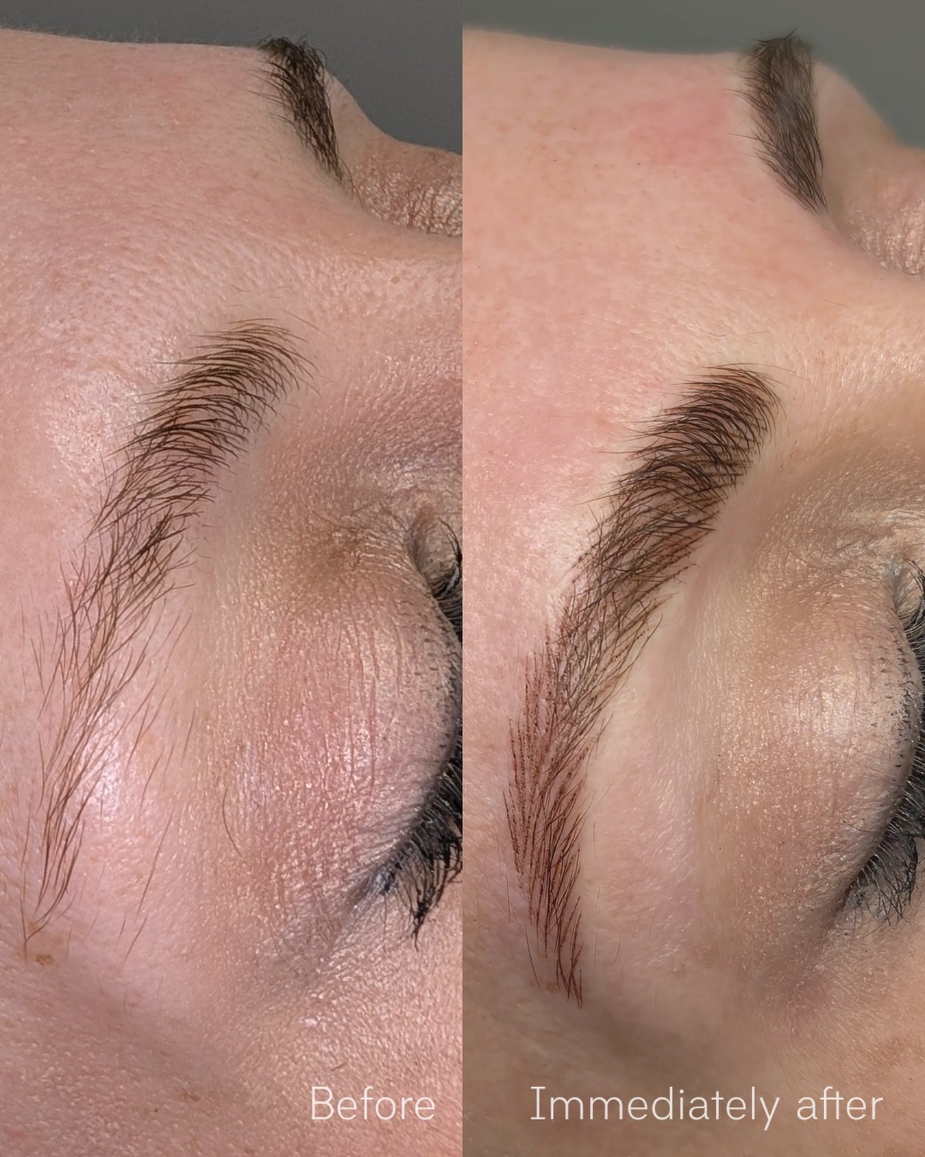 ✨ Why choose Nano Hairstrokes?

&bull; Hyper-realistic hair strokes that blend seamlessly with your natural brows.
&bull; A bespoke brow design, individually tailored to your facial features and aesthetic.
&bull; Soft, elegant definition that enhance