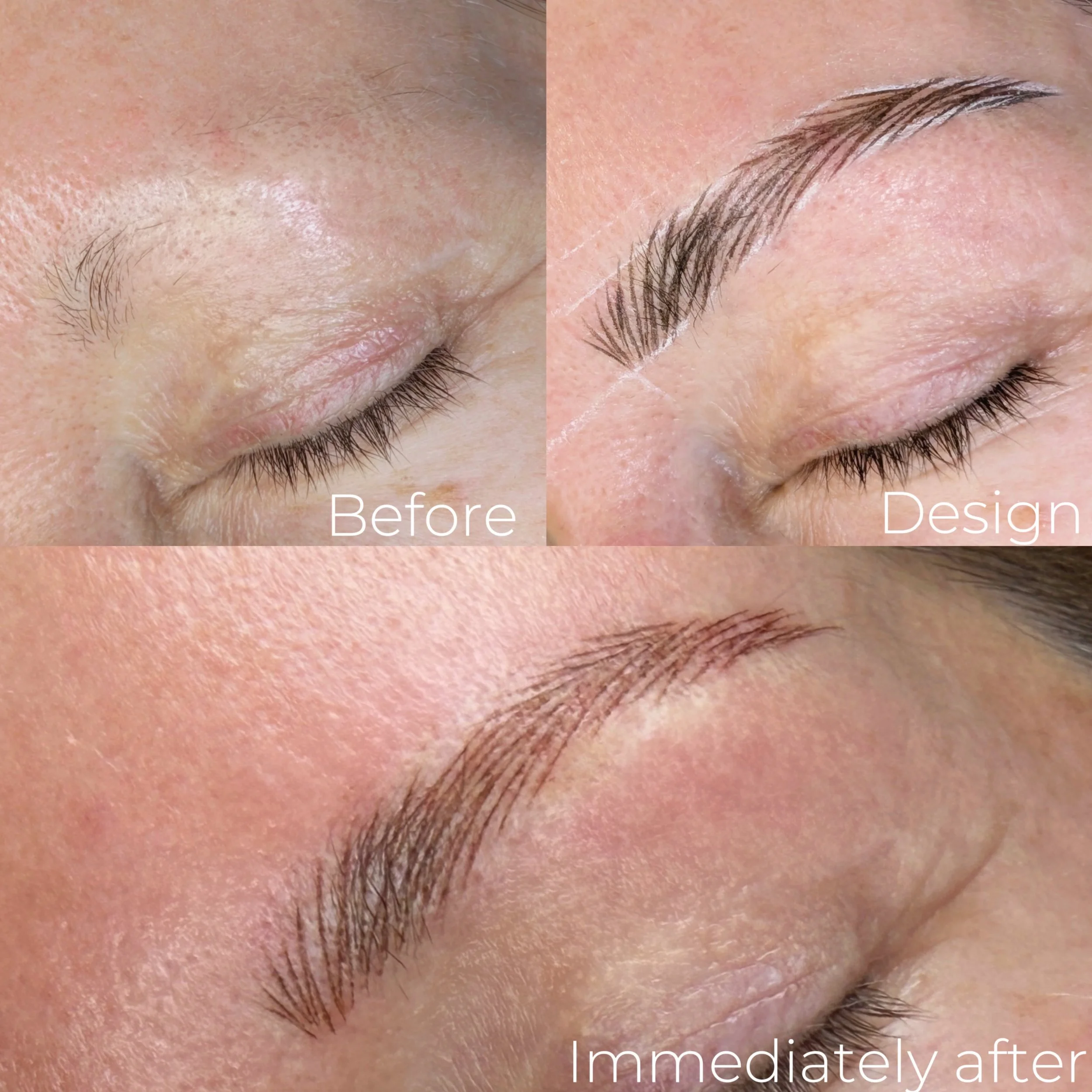 What are Nano Hair Strokes?
An advanced cosmetic tattoo technique that creates ultra-fine, realistic hair-like strokes to mimic the appearance of natural eyebrow hairs. 

Nano brows are suitable for most skin types and are designed to heal beautifull