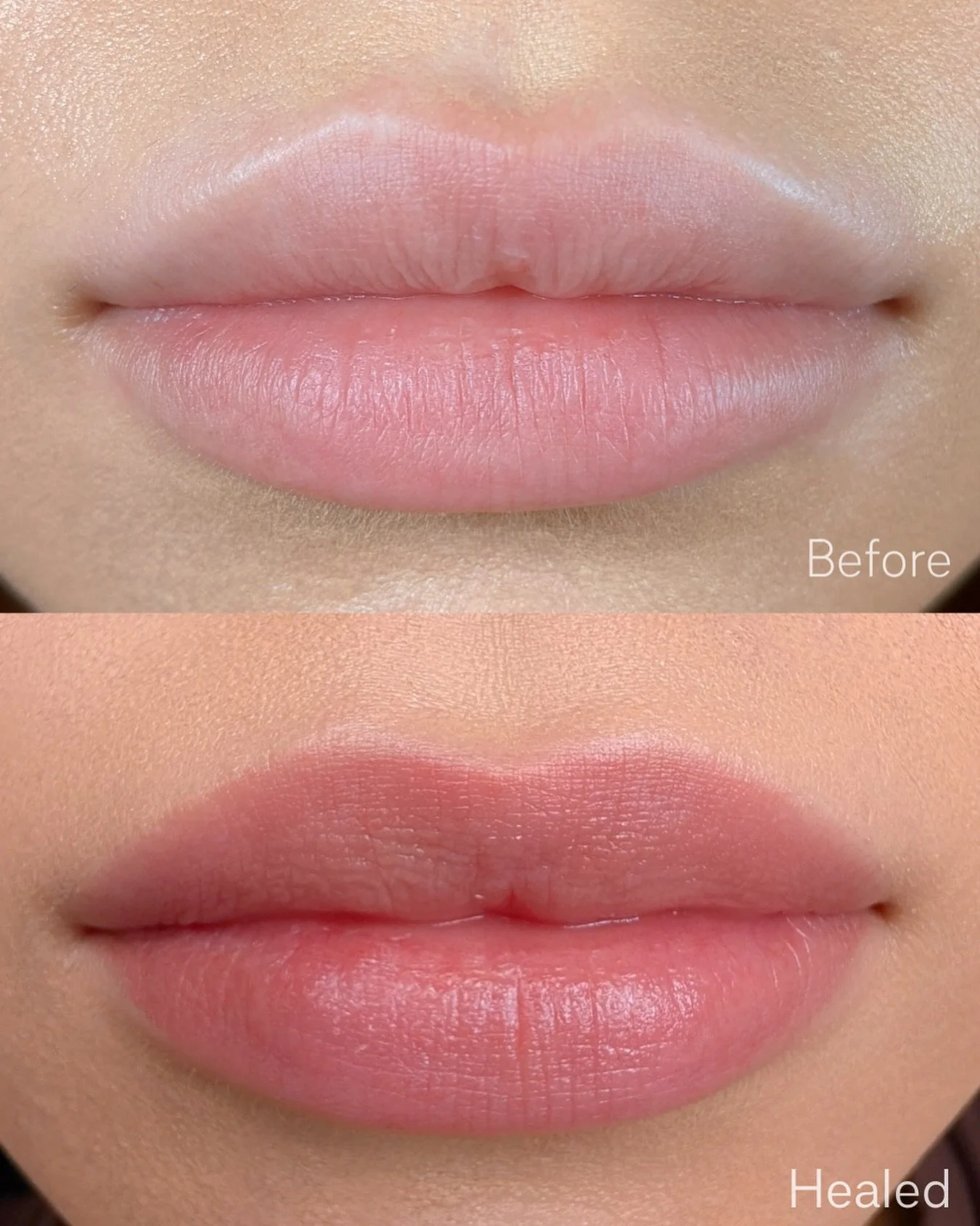 Before vs. healed results ✨

(Nothing applied to the lips, just the natural healed result).

Your lips, but better 👄✨

Pigments used: @hanafycolourspigments 
70% Soft Beige, 20% Alicante, 10% Rose + Thinner 
Needle: 0.301RL Medium taper 
Machine: Bi
