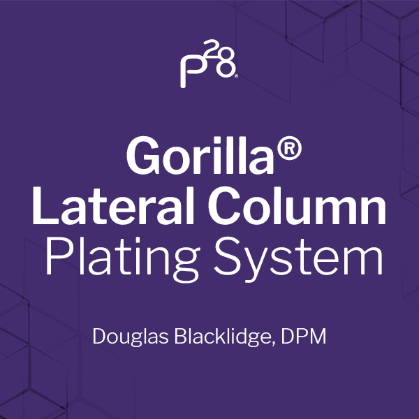 Gorilla® MTP Plating System – Paragon 28
