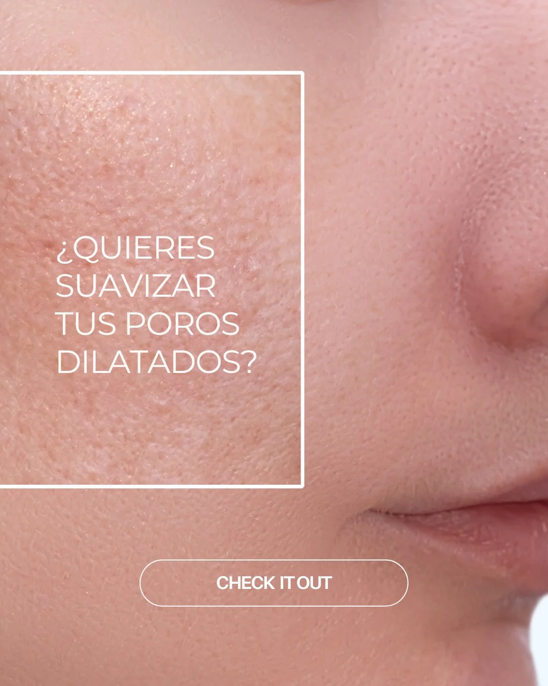 Si notas poros visibles o exceso de grasa, tu piel te est&aacute; pidiendo equilibrio. ✨

Radiance ayuda a purificar, calmar el enrojecimiento y mejorar la apariencia de los poros mientras ilumina con energ&iacute;a de citrino.

🫧 &Uacute;salo despu