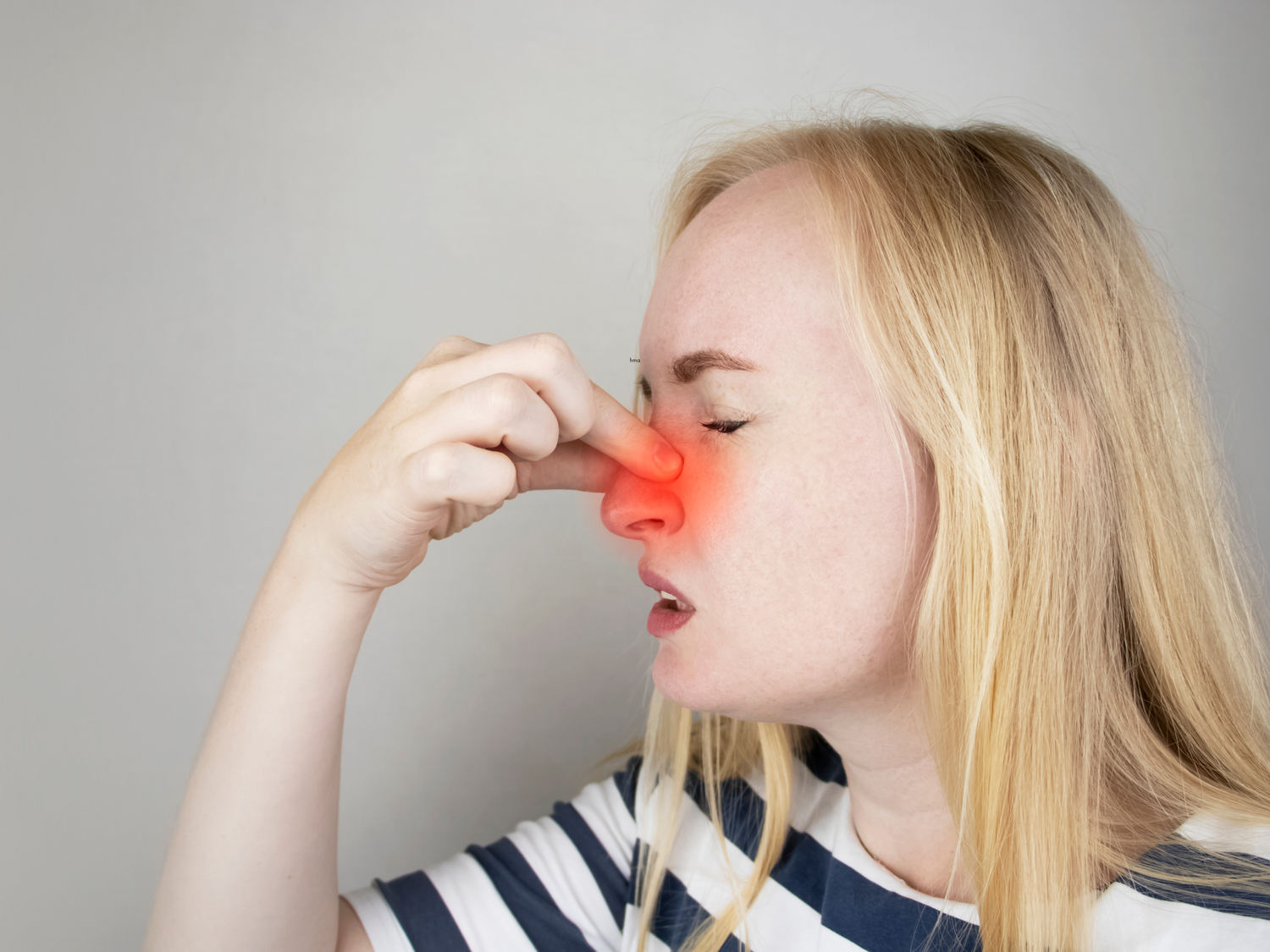 Nasal Polyps — Bay Area Allergy & Asthma Specialists