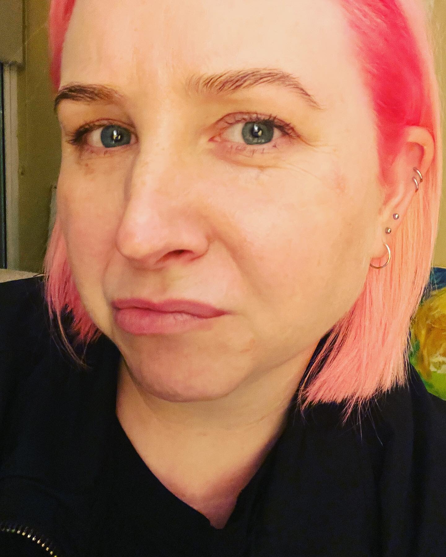 I have a coldsore in my eye. 

So. I have #pinkeye and #pinkhair 

This is #fashion.