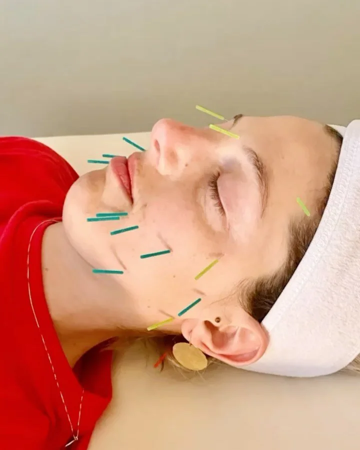 Be Well Acupuncture Encinitas