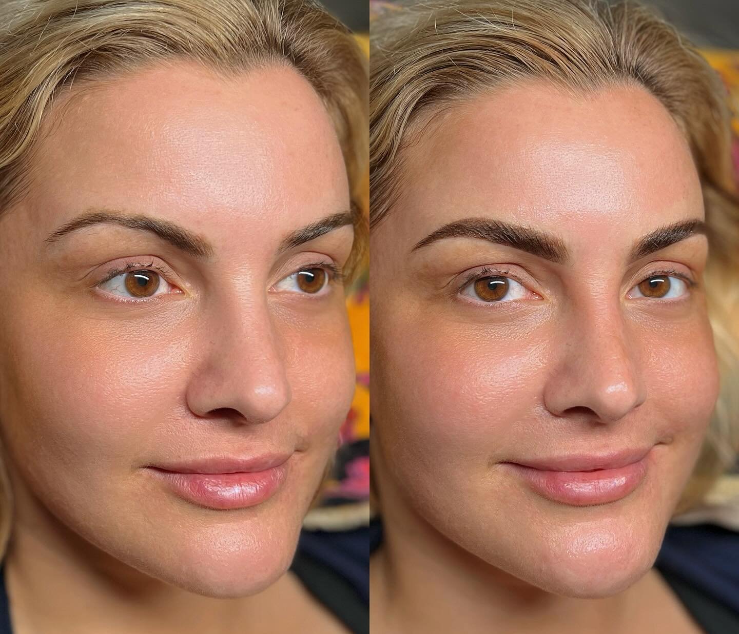 The lovely @katdunn came into @honeydrip_aesthetics_ to receive a color correction+cover up. 🍯🐝We were able to balance out the brow with proper shaping and a color enhancement. What do you think? 😜