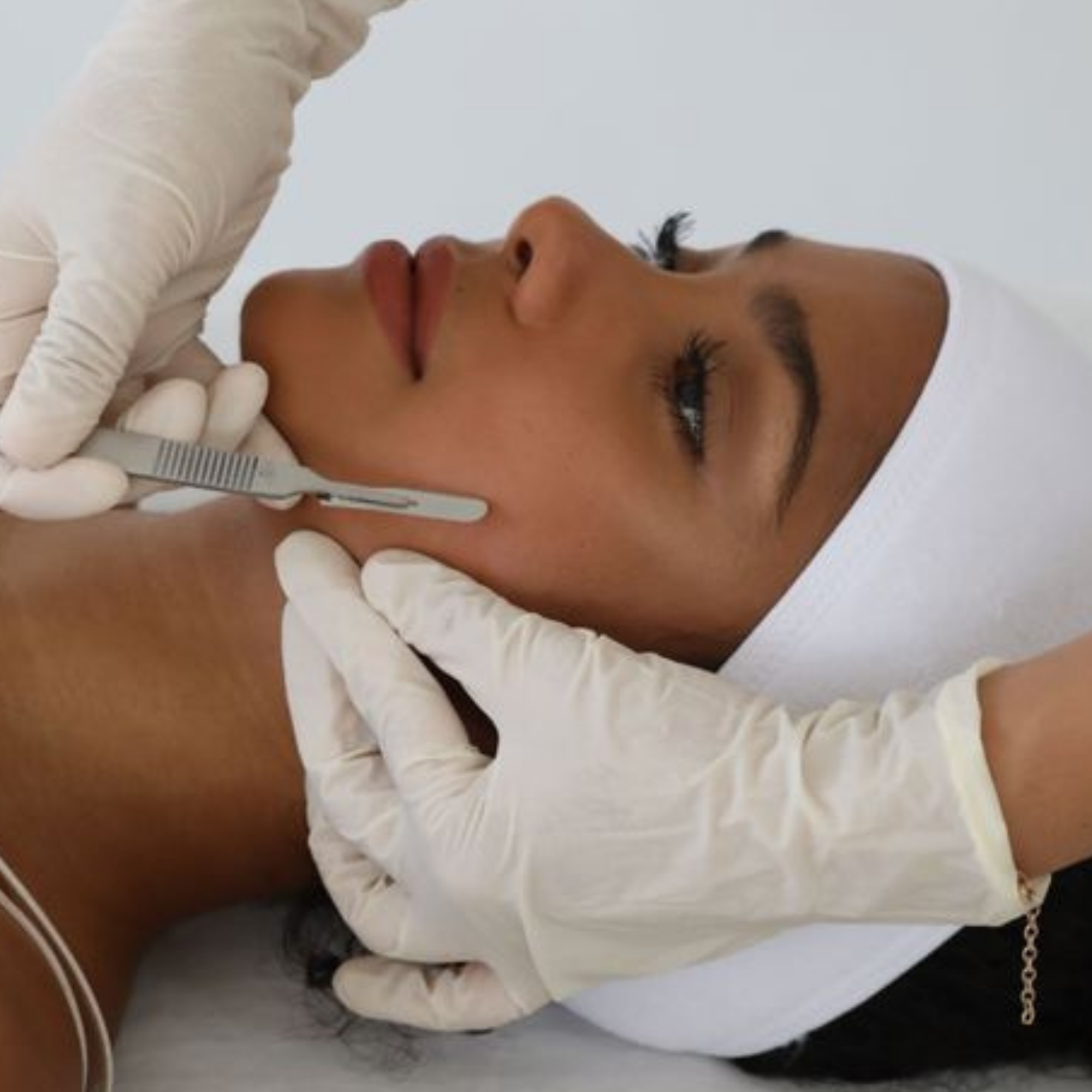 The Skin Reset