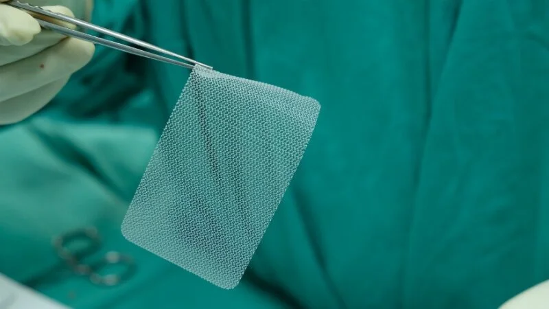mesh+image+2.jpg