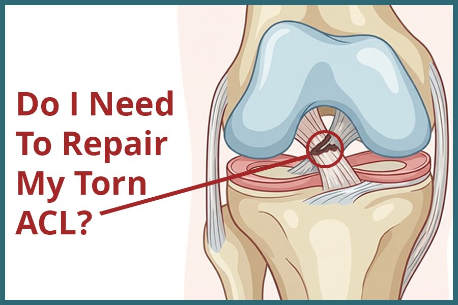 Do I Need To Repair My Torn ACL?