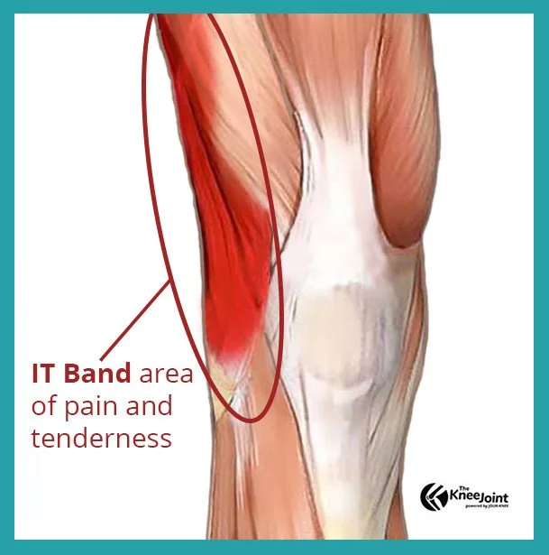 Anatomical illustration of the outer right knee showing the IT band highlighted in red. A callout identifies the IT Band area of pain and tenderness along the lateral thigh, just above the knee joint. The Knee Joint appears in the lower right corner.