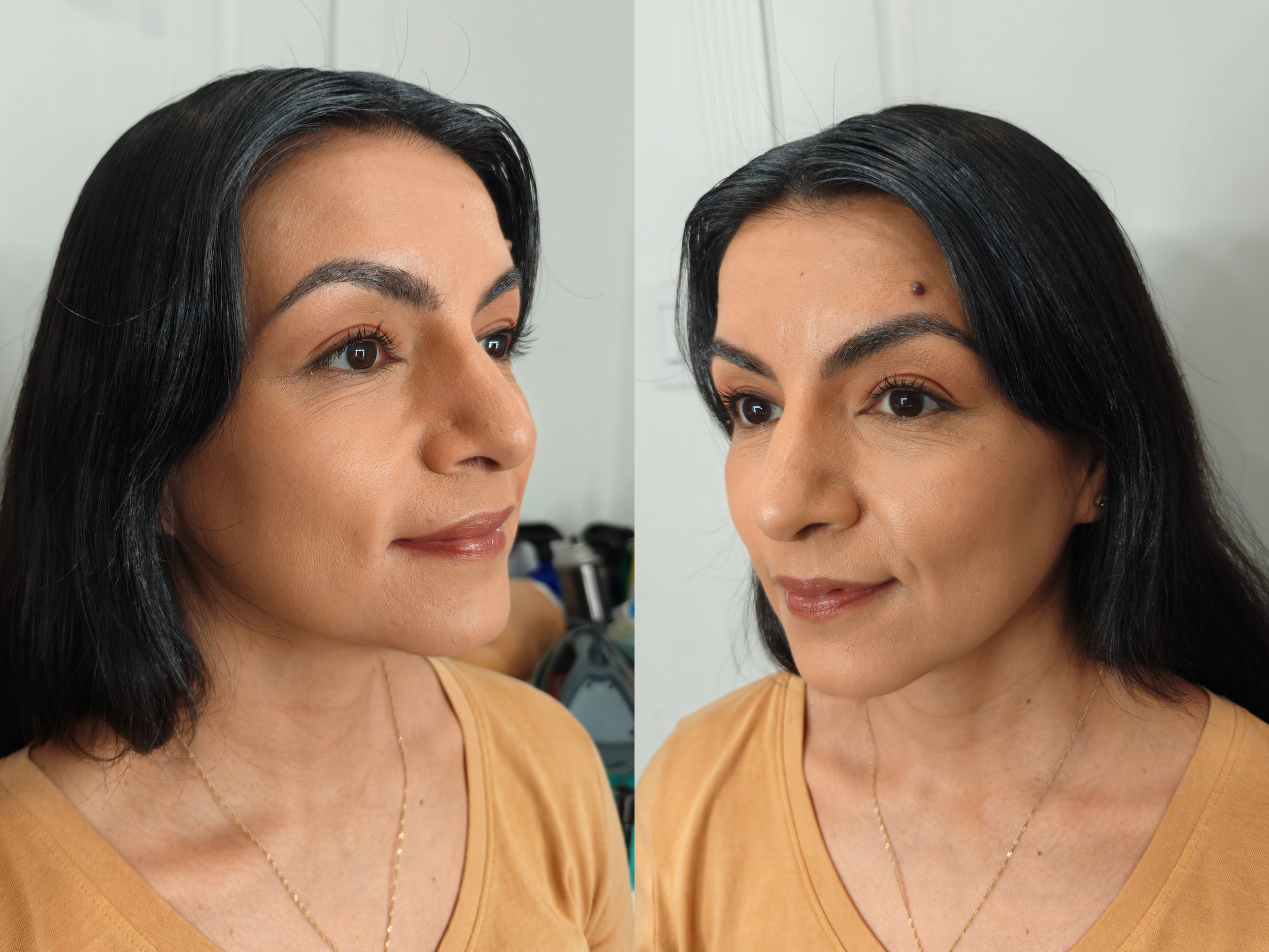 After (sides)