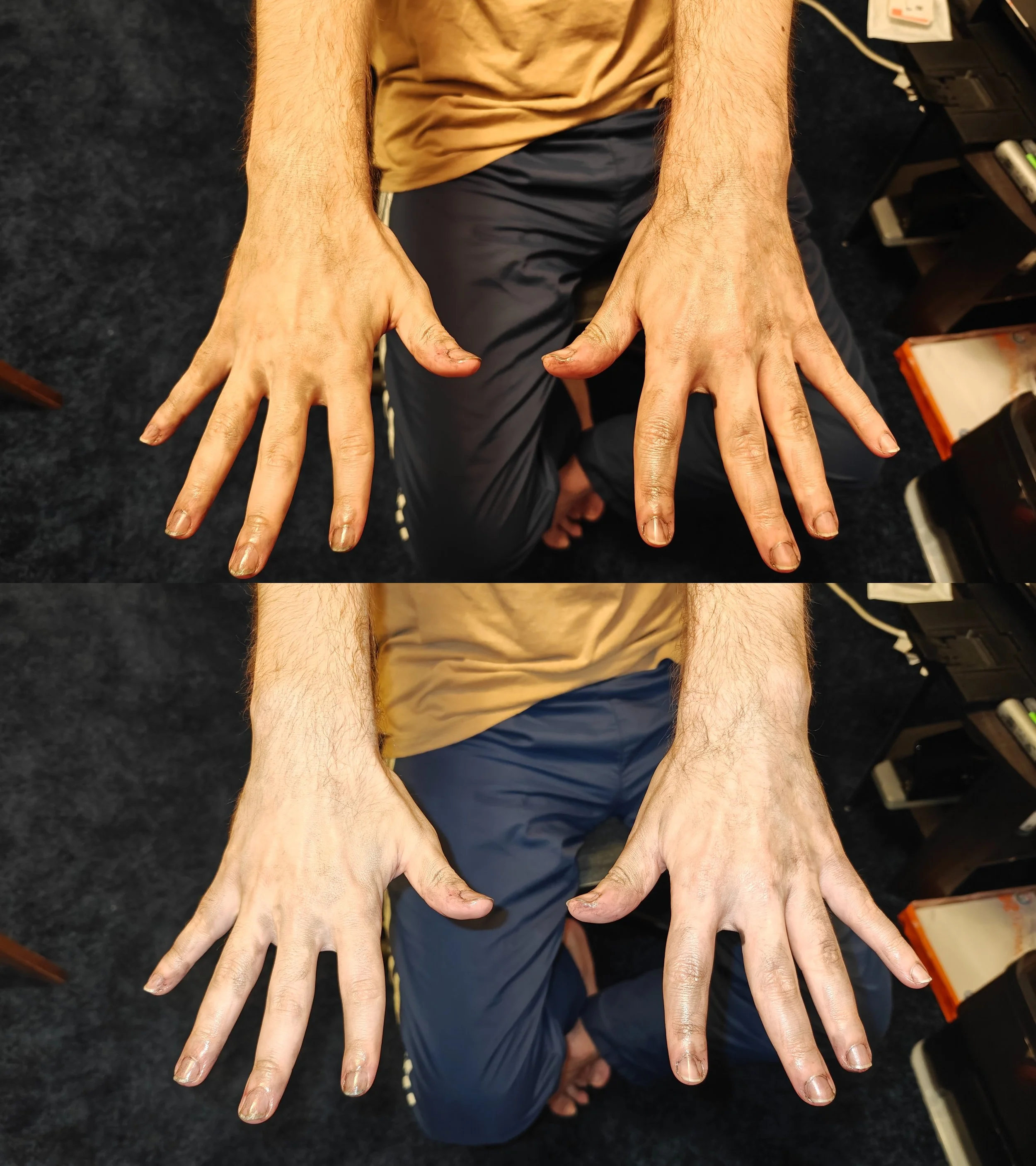 Process (back of hands)