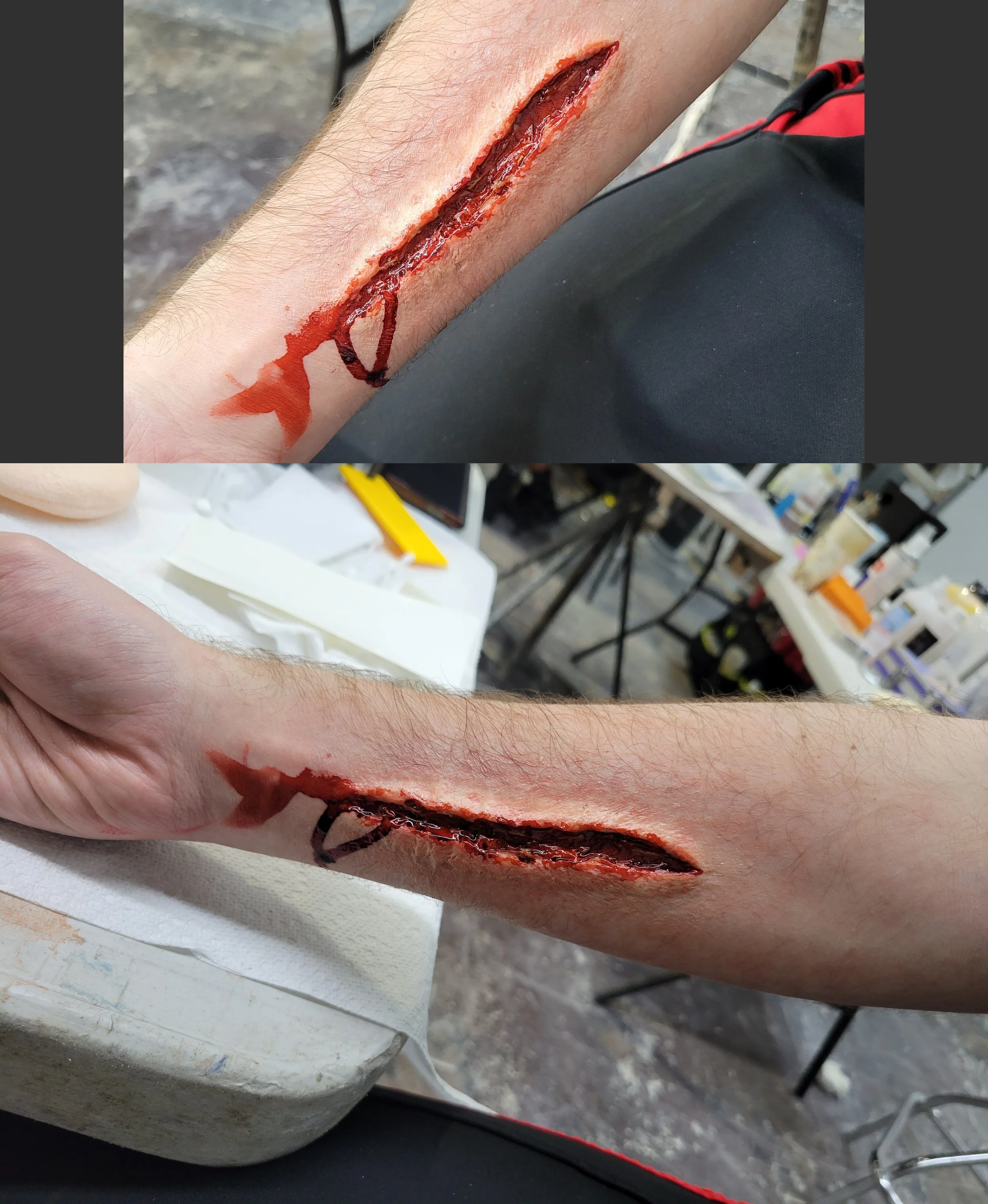 pros transfer blood.jpg