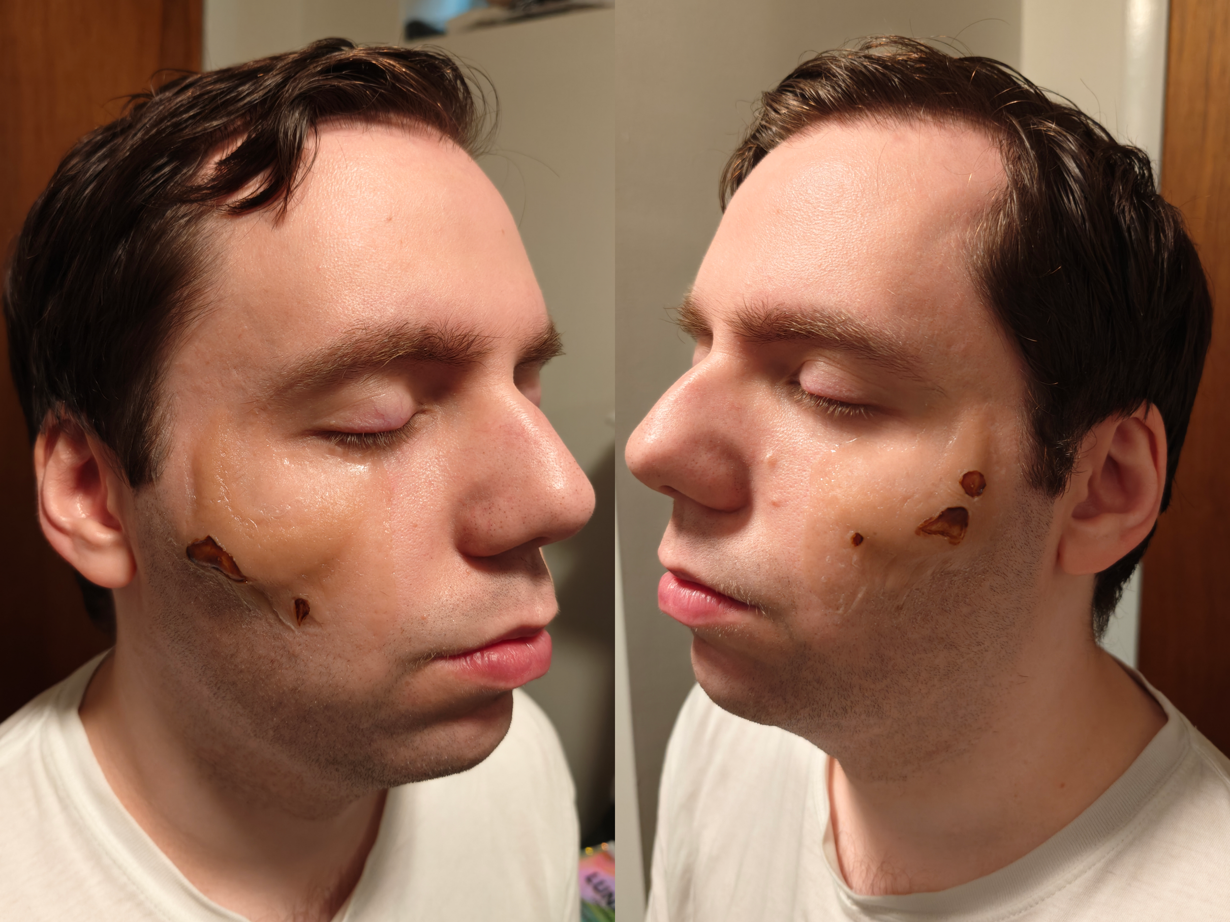 Process 1 (sides)