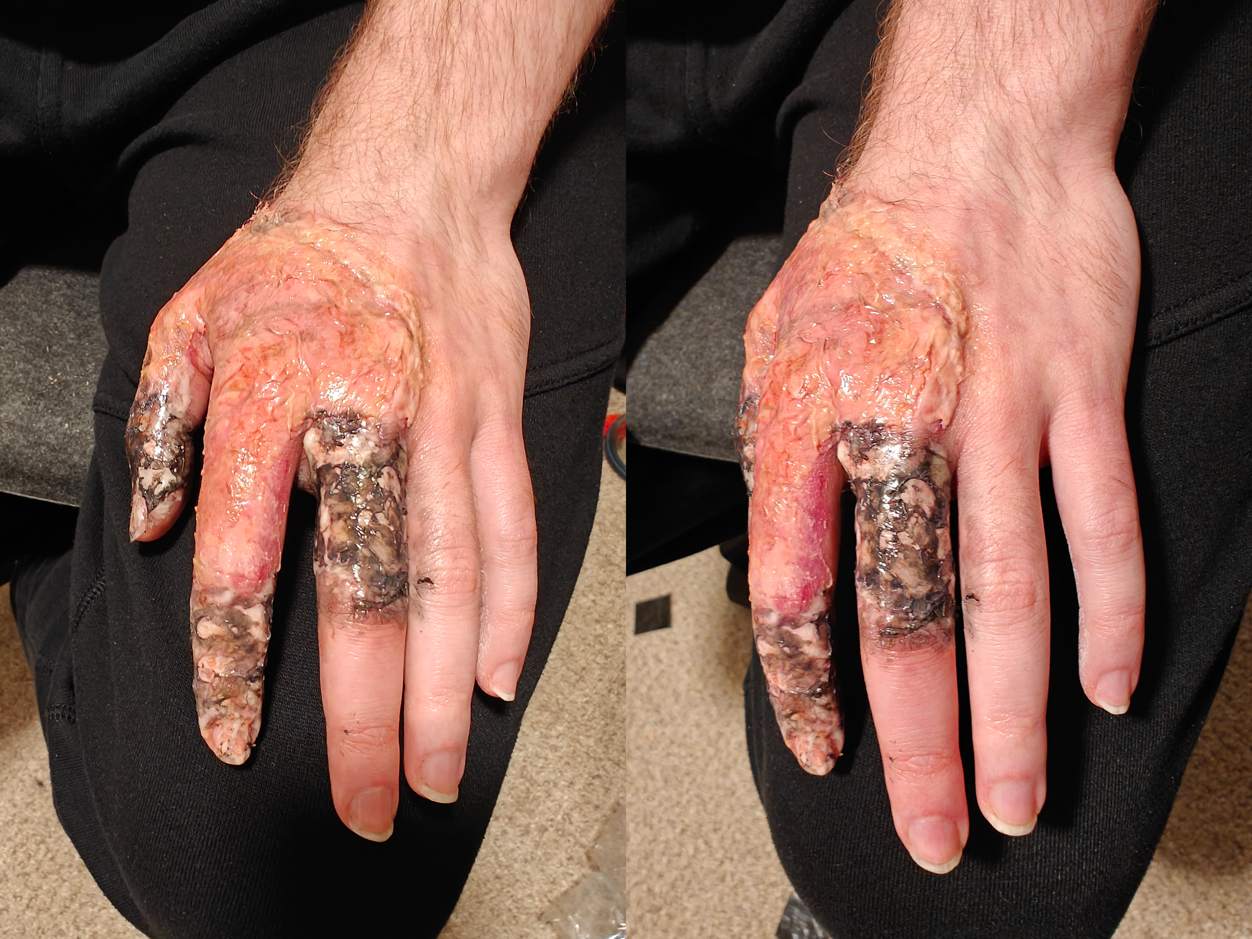 andrew burn after.png