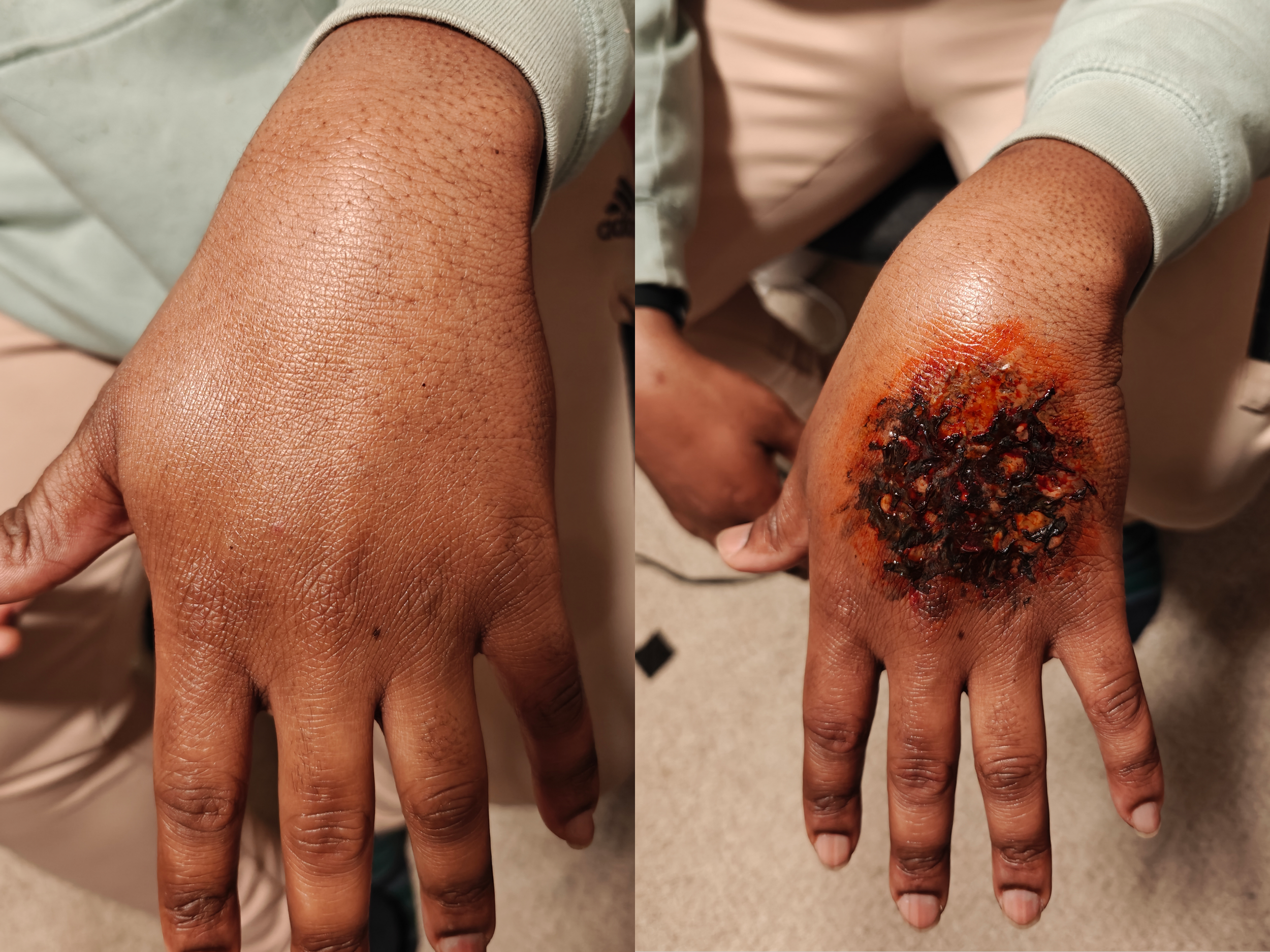 Jay Burn Before After.png