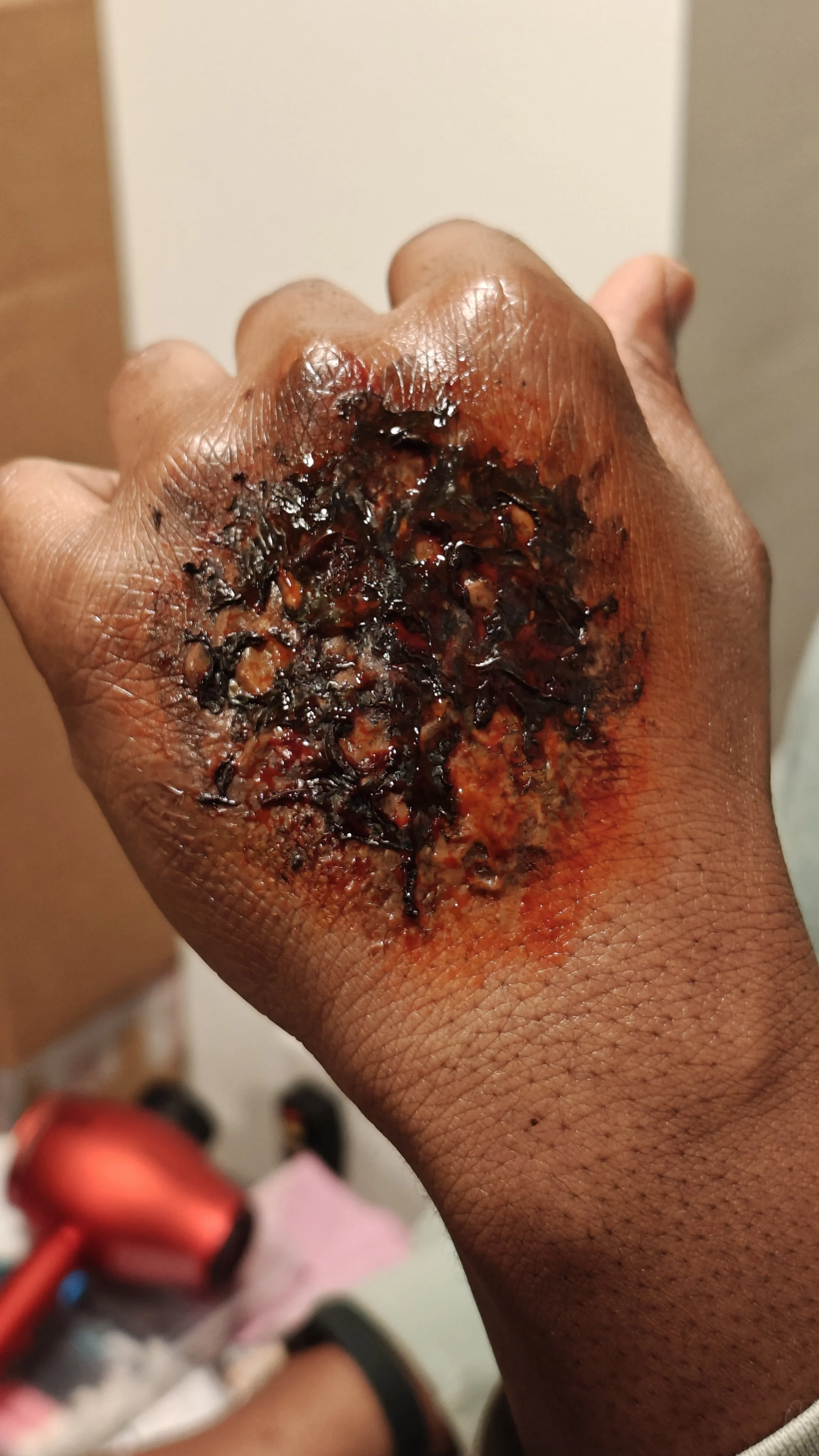 Jay Burn After Alt.jpg