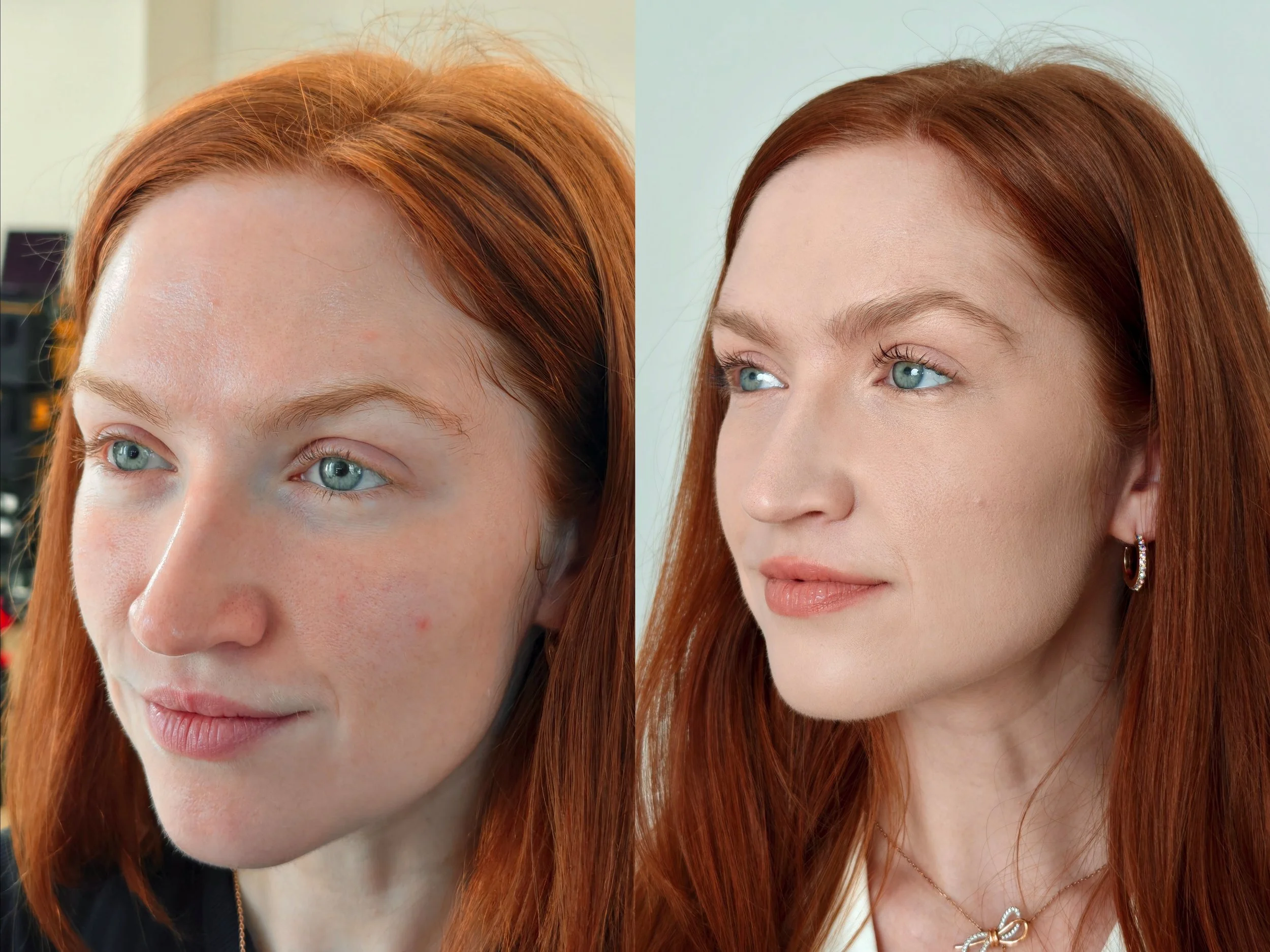 beauty before left.jpg