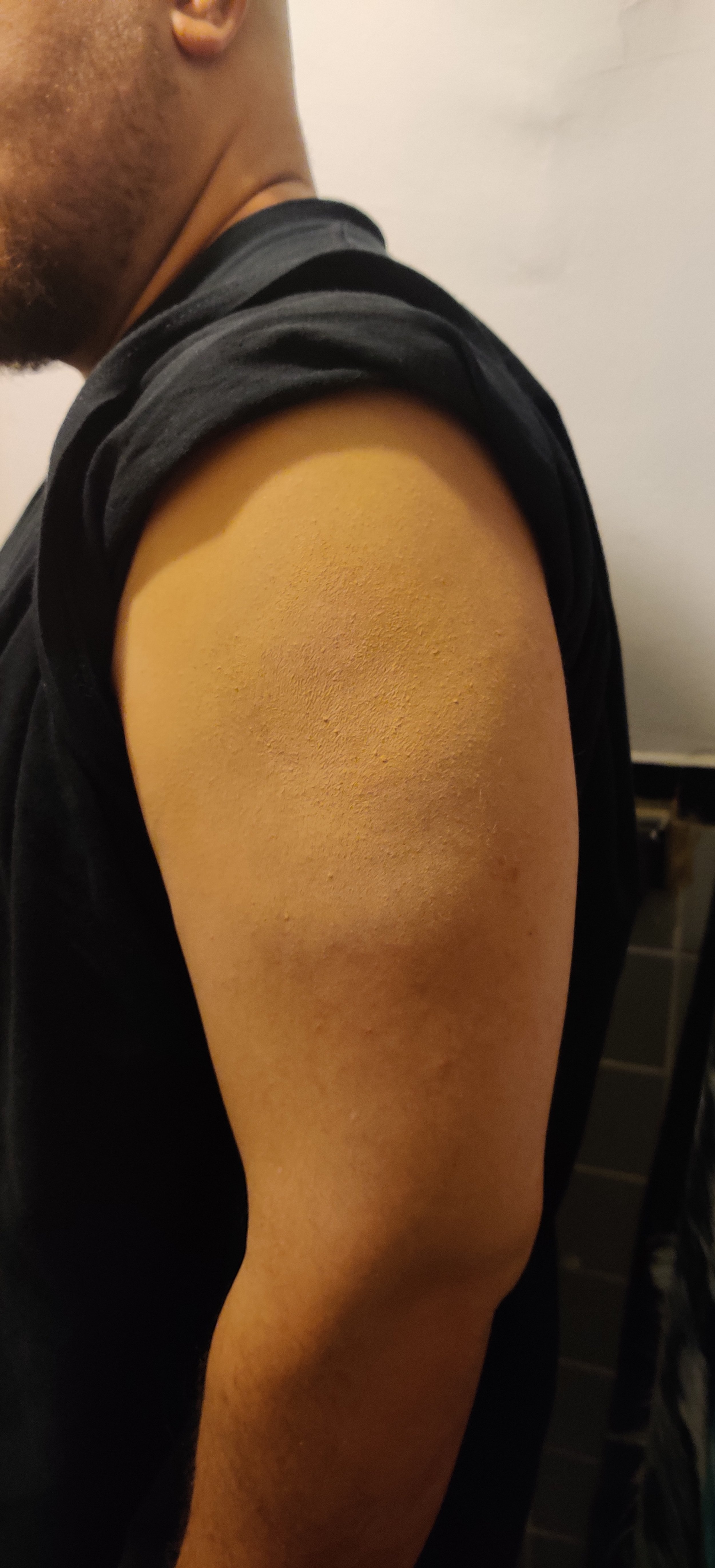 After (alternate view)