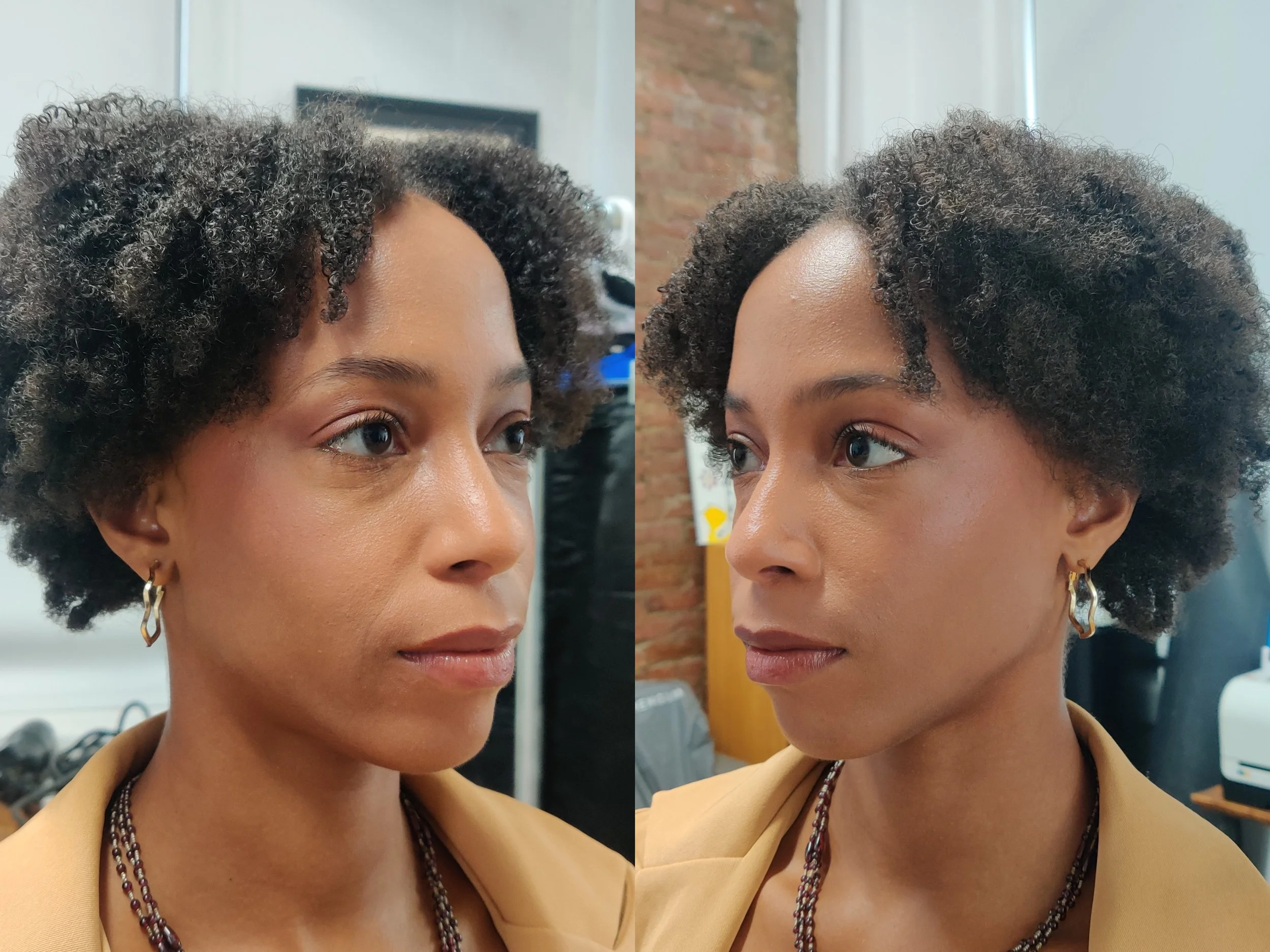 After (sides)